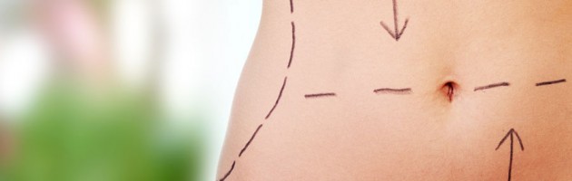 Dr Simeon Wall Jr. - SAFE Liposuction