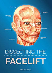 Dissecting the Facelift