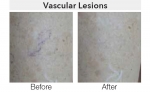 Clinical Magma - Before & After