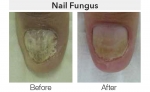 Clinical Magma - Before & After