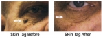 Clinical Skin Clear - Before & After