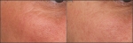 Factor4 - Before and After