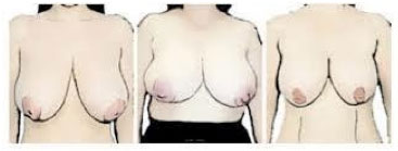 Bra Fitting