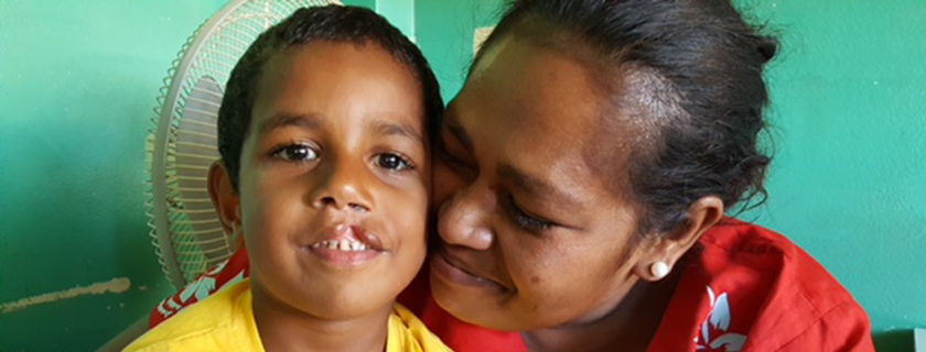 Interplast – Improving quality of life through plastic surgery. Iowane’s Story – a 4yr old Fijian boy with a cleft lip