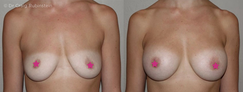 breast surgeon