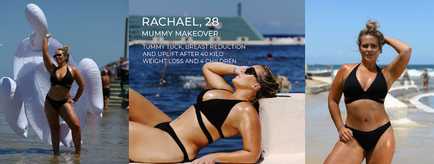 Rachael's Mummy Makeover