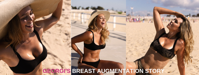 Georgi's Breast Augmentation