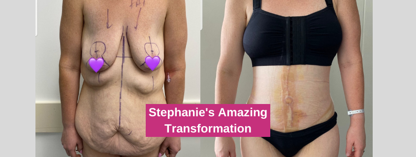 Stephanie's Amazing Transformation