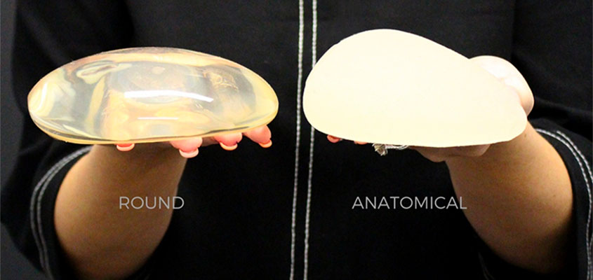 Breast Implants - Shape Matters