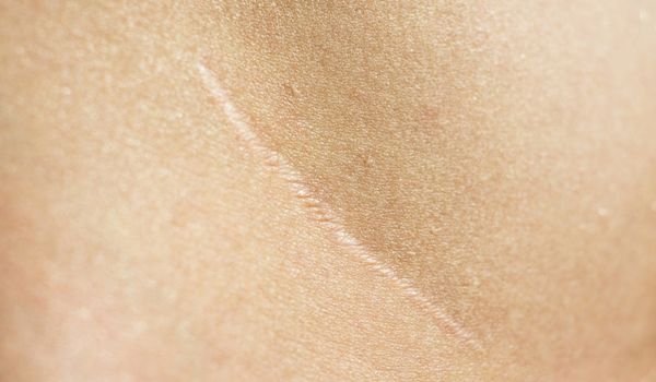 Best Scar Products