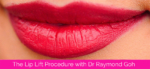 Lip Lift Surgery with Dr Raymond Goh
