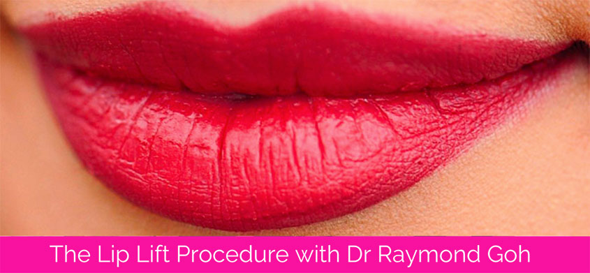 Lip Lift Surgery with Dr Raymond Goh
