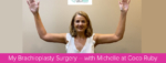 Michelle's Brachioplasty Surgery