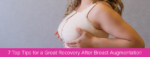 7 Top Tips For a Great Recovery After Breast Augmentation