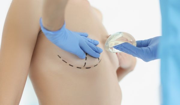 Causes of Symmastia - Excessive tissue dissection