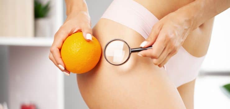 Aveli - a solution for cellulite